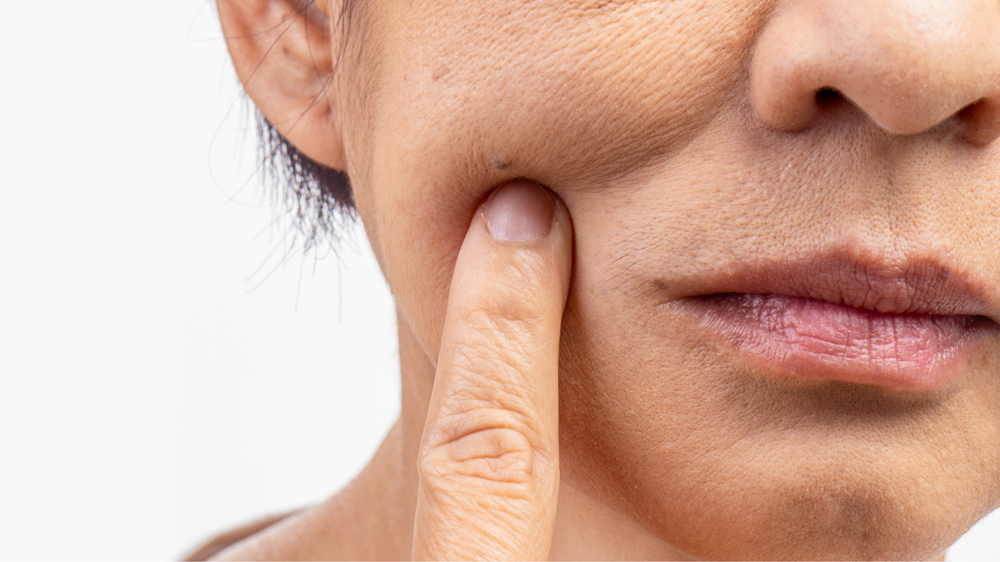 肌の老化、ほんとうの原因はどこにある？